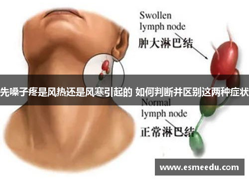 先嗓子疼是风热还是风寒引起的 如何判断并区别这两种症状